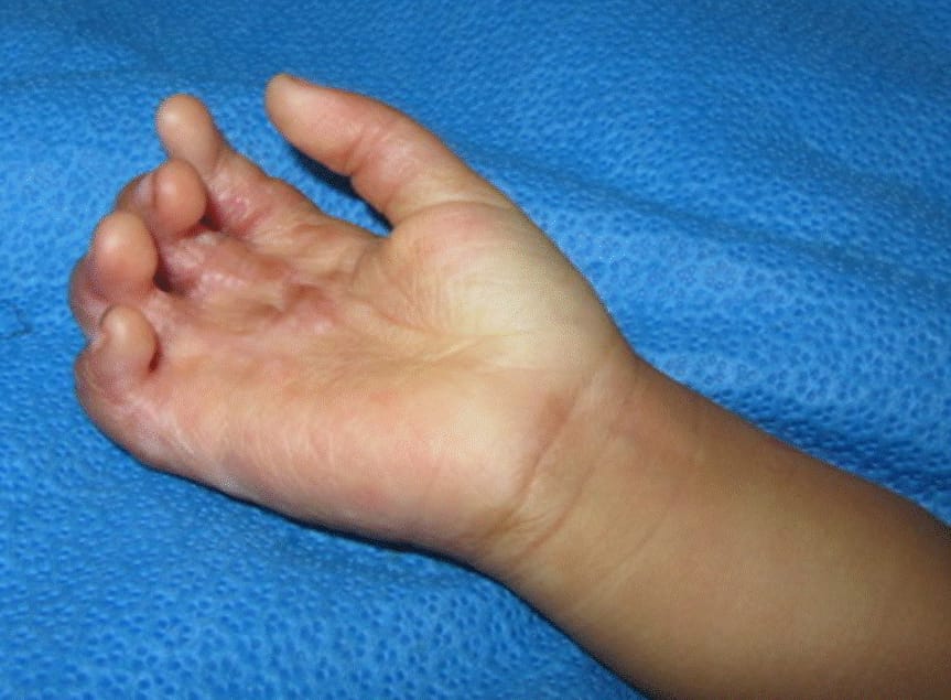 hand surgery karachi
